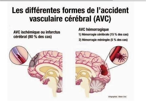 my avc canvas